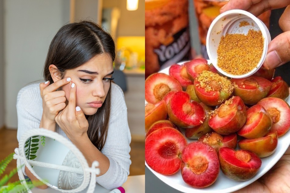 Ăn mận có béo không? Bí quyết ăn mận đúng cách để không lo tăng cân