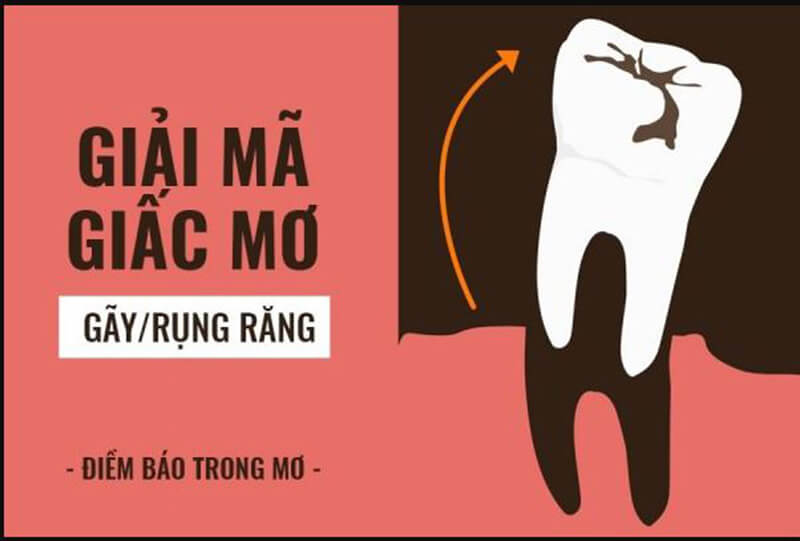 Nằm mơ thấy rụng răng đánh số mấy? Giải mã điềm báo cực chuẩn